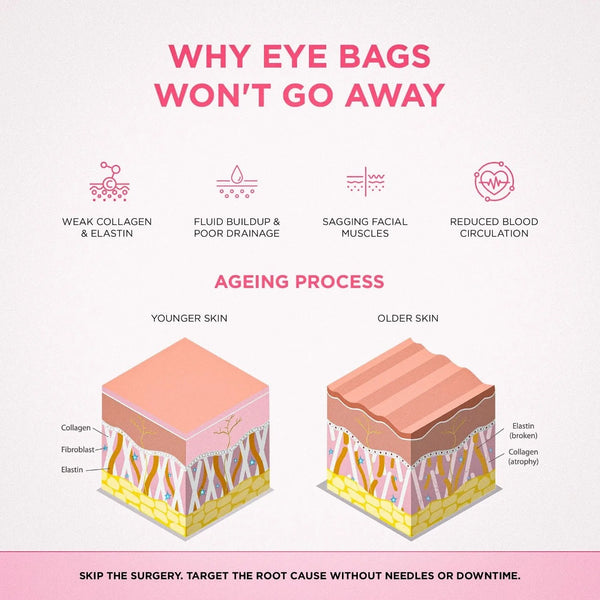 2-in-1 Red Light Therapy + EMS To Erase Eye Bags